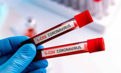 Coronavirus, 162 casi positivi, 42 anni l'età media. 20 casi in provincia