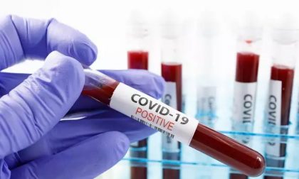 Coronavirus: 671 nuovi casi, età media 44 anni. 34 casi in provincia